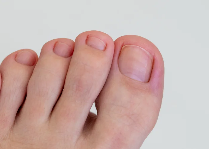 Close-up of the toes and toenails of a bare foot