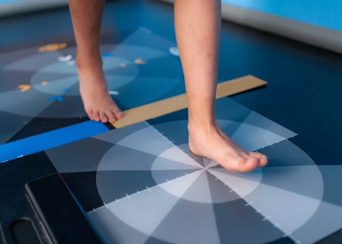 A patient standing on a pressure plate during a static gait assessment